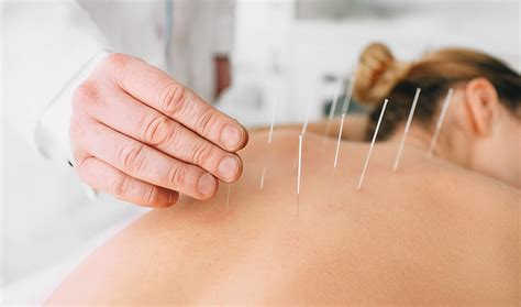 Poke Acupuncture .